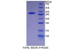 SDS-PAGE analysis of Mouse KHDRBS1 Protein. (KHDRBS1 Protein)