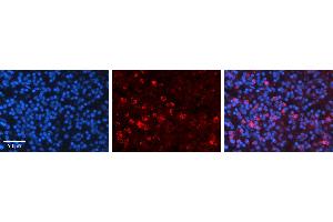 Rabbit Anti-CCNB1 Antibody   Formalin Fixed Paraffin Embedded Tissue: Human Lymph Node Tissue Observed Staining: Cytoplasm Primary Antibody Concentration: 1:600 Other Working Concentrations: N/A Secondary Antibody: Donkey anti-Rabbit-Cy3 Secondary Antibody Concentration: 1:200 Magnification: 20X Exposure Time: 0. (Cyclin B1 antibody  (C-Term))