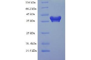 SDS-PAGE (SDS) image for Programmed Cell Death 10 (PDCD10) (AA 1-212), (full length) protein (His-SUMO Tag) (ABIN5711751)