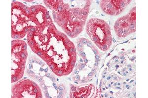 Anti-SLC6A3 / Dopamine Transporter antibody IHC of human kidney. (SLC6A3 antibody  (EL2 Region))