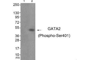 Western blot analysis of extracts from JK cells (Lane 2), using GATA2 (Phospho-Ser401) Antibody. (GATA2 antibody  (pSer401))