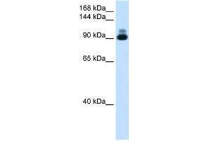 WB Suggested Anti-ACTN2 Antibody Titration:  1. (ACTN2 antibody  (C-Term))