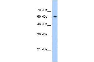 Human Jurkat; WB Suggested Anti-ZNF675 Antibody Titration: 1. (ZNF675 antibody  (C-Term))