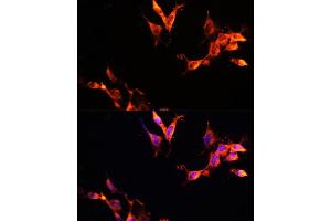 Immunofluorescence (IF) image for anti-Late Endosomal/lysosomal Adaptor, MAPK and mTOR Activator 1 (LAMTOR1) (AA 1-161) antibody (ABIN6143083)