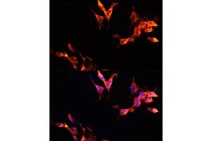 Immunofluorescence analysis of NIH-3T3 cells using L Polyclonal Antibody (ABIN6133274, ABIN6143083, ABIN6143084 and ABIN6215309) at dilution of 1:100 (40x lens). (LAMTOR1 antibody  (AA 1-161))