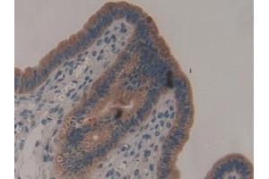 Immunohistochemistry (IHC) image for anti-ADAM Metallopeptidase with Thrombospondin Type 1 Motif, 2 (Adamts2) (AA 855-1030) antibody (ABIN7440095)