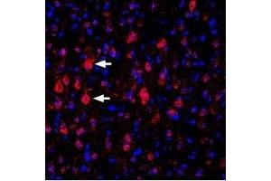 Expression of KV1. (Kv1.4 antibody  (1st Extracellular Loop))