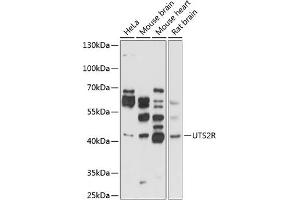 Western blot analysis of extracts of various cell lines, using UTS2R antibody (ABIN3017070, ABIN3017071, ABIN3017072 and ABIN6219939) at 1:1000 dilution.