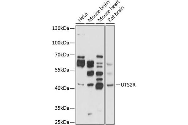 UTS2R 抗体  (AA 280-389)