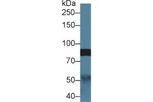 Detection of Slit1 in Rat Cerebrum lysate using Polyclonal Antibody to Slit Homolog 1 (Slit1) (SLIT1 antibody  (AA 647-835))