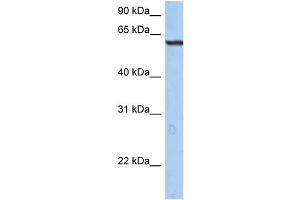 WB Suggested Anti-TRIM22 Antibody Titration: 0. (TRIM22 antibody  (N-Term))