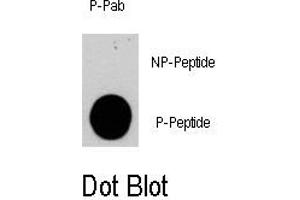 Image no. 1 for anti-Phosphoinositide-3-Kinase, Catalytic, gamma Polypeptide (PIK3CG) (pSer1100) antibody (ABIN358396) (PIK3 gamma antibody  (pSer1100))