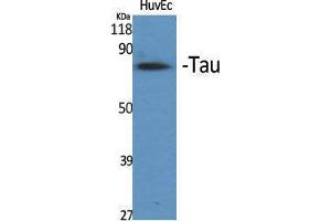 Western Blotting (WB) image for anti-tau Protein (Ser83) antibody (ABIN3187173) (tau antibody  (Ser83))