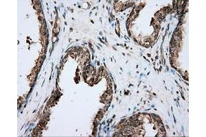 Immunohistochemical staining of paraffin-embedded prostate tissue using anti-PIM2 mouse monoclonal antibody. (PIM2 antibody)