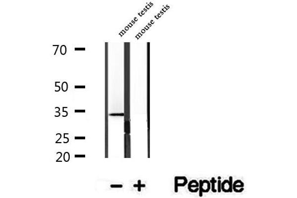 WBP2NL antibody  (Internal Region)