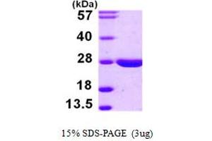 SDS-PAGE (SDS) image for Lysophospholipase II (LYPLA2) (AA 1-231) protein (His tag) (ABIN667877)