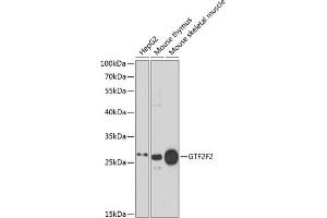 Western blot analysis of extracts of various cell lines, using GTF2F2 antibody (ABIN6131726, ABIN6141494, ABIN6141496 and ABIN6217519) at 1:1000 dilution. (GTF2F2 antibody  (AA 1-249))
