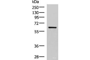 Western blot analysis of Human fetal brain tissue lysate using SARS Polyclonal Antibody at dilution of 1:850 (Seryl-tRNA Synthetase (SARS) antibody)