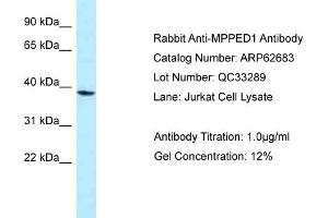 Western Blotting (WB) image for anti-metallophosphoesterase Domain Containing 1 (MPPED1) (Middle Region) antibody (ABIN2789208) (MPPED1 antibody  (Middle Region))