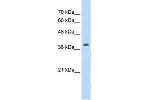 Western Blotting (WB) image for anti-Tropomyosin 1 (Alpha) (TPM1) antibody (ABIN2462395)