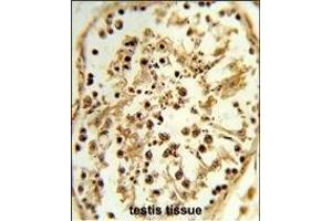 Immunohistochemistry (Paraffin-embedded Sections) (IHC (p)) image for anti-T-Box 1 (TBX1) (AA 327-356), (C-Term) antibody (ABIN653331)