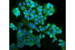 anti-G-Rich RNA Sequence Binding Factor 1 (GRSF1) (AA 119-405) antibody