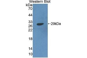 Detection of Recombinant HADH, Human using Polyclonal Antibody to Hydroxyacyl Coenzyme A Dehydrogenase (HADH) (HADH antibody  (AA 1-236))