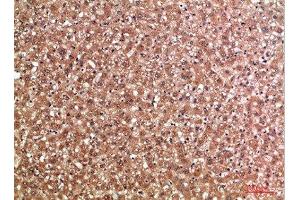 Immunohistochemical analysis of paraffin-embedded human-liver, antibody was diluted at 1:200