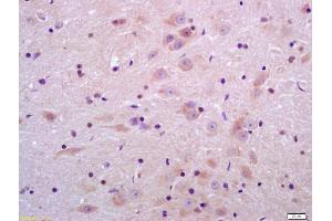 Formalin-fixed and paraffin embedded rat brain labeled with Anti-Sulfatase 2 Polyclonal Antibody, Unconjugated (ABIN750763) at 1:200 followed by conjugation to the secondary antibody and DAB staining (SULF2 antibody  (AA 651-750))