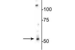 Western blot of rat brain lysate showing specific immunolabeling of the ~53 kDa β3-subunit of the GABAA-R. (GABRB3 antibody  (Cytoplasmic Loop))