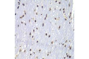 Immunohistochemistry of paraffin-embedded mouse brain using Lyn antibody (ABIN4904272) at dilution of 1:100 (40x lens).