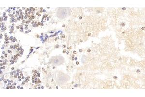 Detection of HIST2H3A in Human Cerebellum Tissue using Polyclonal Antibody to Histone Cluster 2, H3a (HIST2H3A) (HIST2H3A antibody  (AA 1-136))