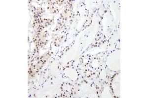 anti-RNA Binding Motif Protein 26 (RBM26) (AA 200-250) antibody