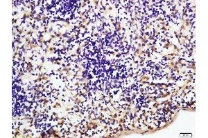 Immunohistochemistry (Paraffin-embedded Sections) (IHC (p)) image for anti-Nuclear Factor-kB p65 (NFkBP65) (AA 51-100) antibody (ABIN668961)