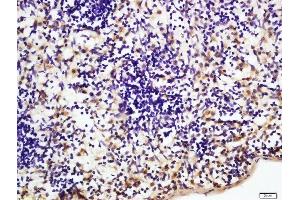 Immunohistochemistry (Paraffin-embedded Sections) (IHC (p)) image for anti-Nuclear Factor-kB p65 (NFkBP65) (AA 51-100) antibody (ABIN668961)