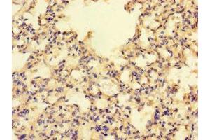 Immunohistochemistry of paraffin-embedded human lung tissue using ABIN7142435 at dilution of 1:100 (MRPL39 antibody  (AA 1-158))