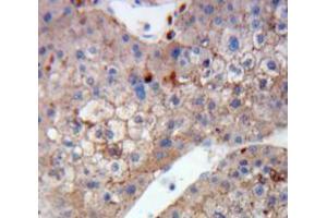 Used in DAB staining on fromalin fixed paraffin-embedded Liver tissue (DCT antibody  (AA 28-263))