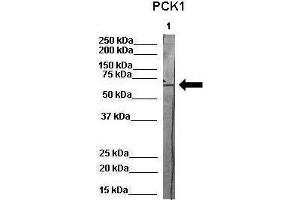 WB Suggested Anti-PCK1 Antibody    Positive Control:  Lane 1: 80ug pig serum protein   Primary Antibody Dilution :   1:1000  Secondary Antibody :  Anti-rabbit-HRP   Secondry Antibody Dilution :   1:500  Submitted by:  Martina Ondrovics, University of Veterinary Medicine Vienna (PCK1 antibody  (Middle Region))
