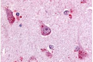 Anti-GPR68 antibody  ABIN1048864 IHC staining of human brain, cortex.