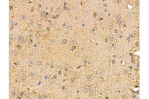 ABIN6258206 and ABIN6274351 at 1/100 staining Rat brain tissue by IHC-P. (GIT2 antibody  (Internal Region))