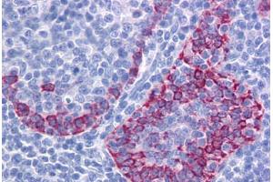 Human Tonsil: Formalin-Fixed, Paraffin-Embedded (FFPE) (EFCAB4A antibody  (Internal Region))