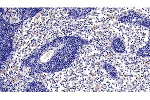 Detection of CD40L in Rat Lymph node Tissue using Polyclonal Antibody to Cluster Of Differentiation 40 Ligand (CD40L) (CD40 Ligand antibody  (AA 180-261))