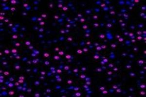 Immunofluorescent analysis of paraformaldehyde-fixed rat adrenal gland using TPRKB (ABIN7075943) at dilution of 1: 1000 (TPRKB antibody)