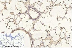 Immunohistochemical analysis of paraffin-embedded rat lung tissue. (TUBB1 antibody)