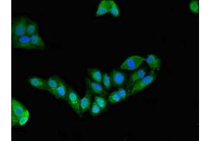 Immunofluorescent analysis of HepG2 cells using ABIN7151428 at dilution of 1:100 and Alexa Fluor 488-congugated AffiniPure Goat Anti-Rabbit IgG(H+L) (EFHD2 antibody  (AA 2-240))