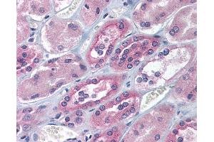 Anti-IGF2BP1 antibody IHC of human kidney. (IGF2BP1 antibody  (AA 155-204))