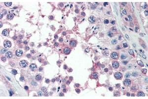 Immunohistochemistry (IHC) image for anti-Mediator Complex Subunit 4 (MED4) (Middle Region) antibody (ABIN2784236)