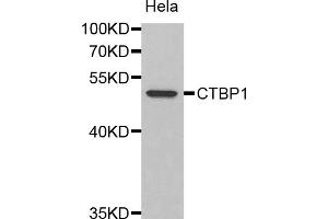 Western blot analysis of extracts of HeLa cells, using CTBP1 antibody (ABIN1872058). (CTBP1 antibody)
