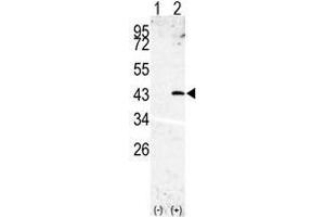 Western blot analysis of SPPL3(arrow) using rabbit polyclonal SPPL3 Antibody (SPPL3 antibody  (N-Term))