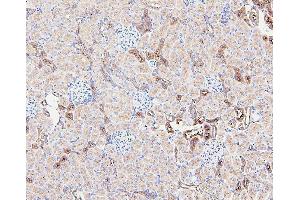 IHC analysis of GUSB using anti-GUSB antibody (ABIN7599854). (Glucuronidase beta antibody  (AA 122-575))